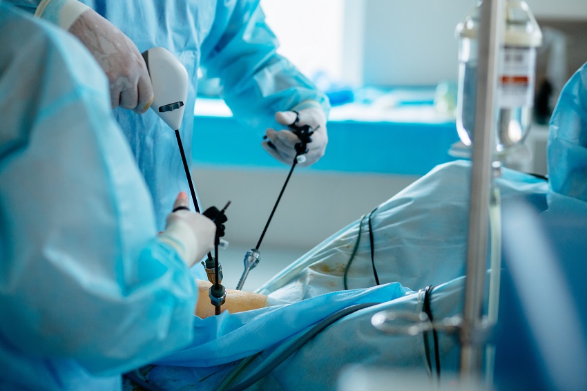O que é laparoscopia?