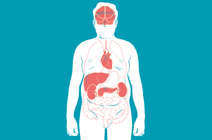 Síndrome Metabólica e Seu Impacto Profundo no Sistema Digestivo