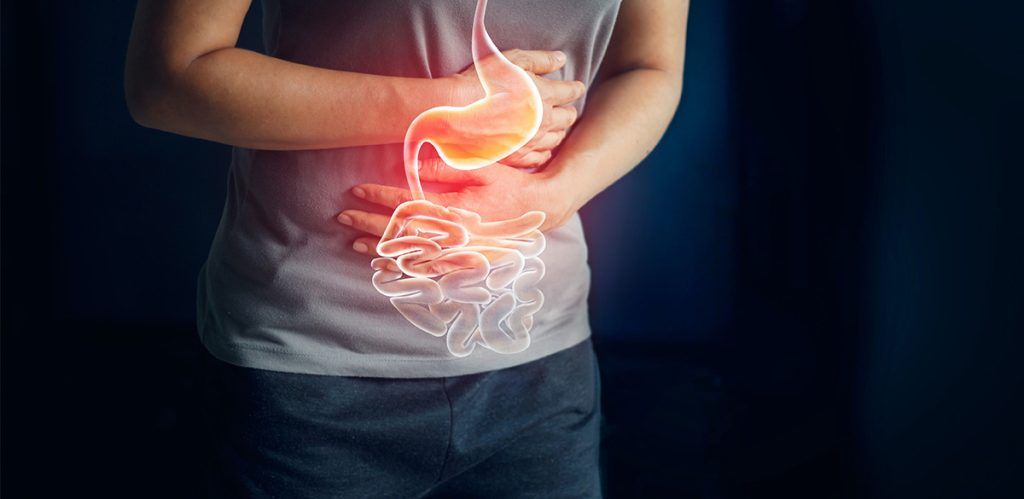 Existe Cura para a Doença de Crohn? Entenda Mais sobre essa Condição Digestiva