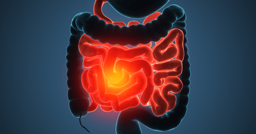 LESÃO DE DIEULAFOY: UMA CAUSA RARA DE SANGRAMENTO GASTROINTESTINAL