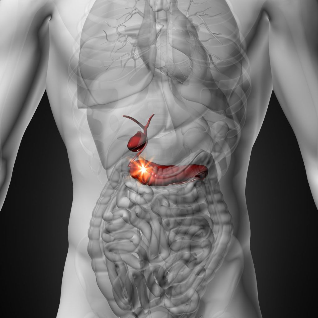 PANCREATITE AGUDA: DIAGNÓSTICO E TRATAMENTO