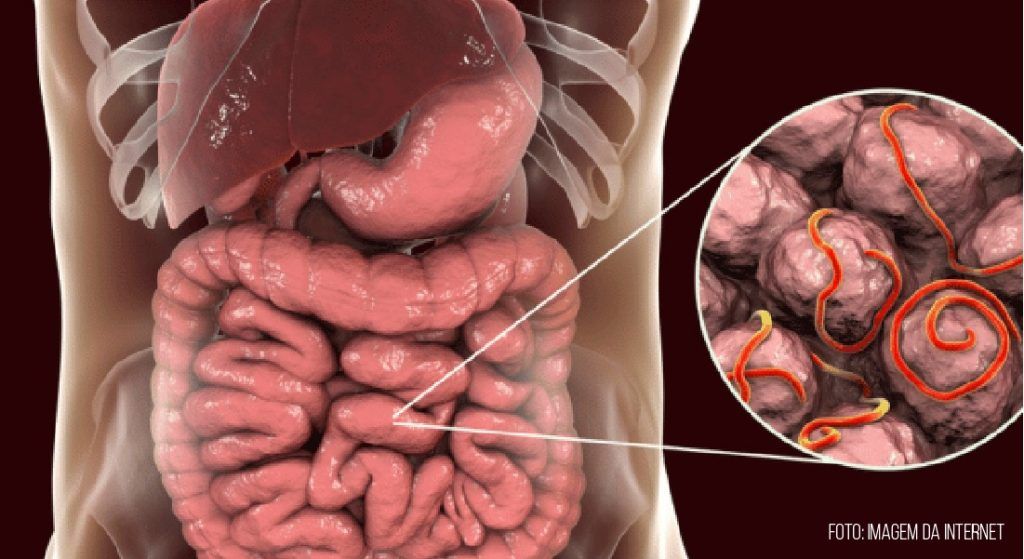 DOENÇAS GASTROINTESTINAIS CAUSADAS POR PARASITAS: O QUE VOCÊ PRECISA SABER