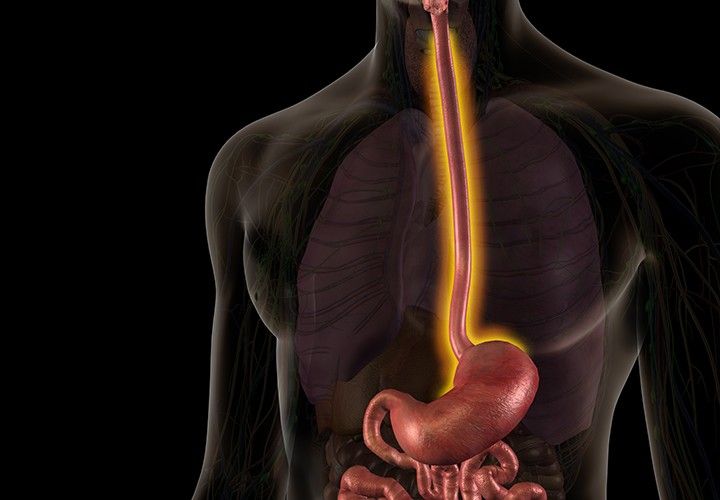 PHMETRIA ESOFÁGICA: O EXAME QUE AJUDA NO DIAGNÓSTICO DO REFLUXO GASTROESOFÁGICO